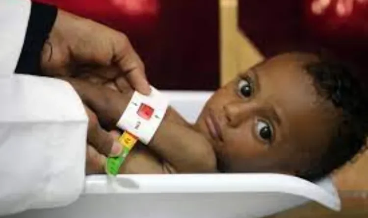 540,000 children starve in Yemen, one dying every 10 minutes: UNICEF