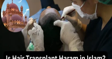 Is hair transplant permissible from Islamic point of view?